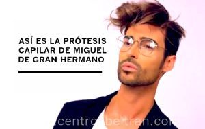 Así es la prótesis capilar de Miguel de Gran Hermano. Desde que empezó la nueva edición de Gran Hermano 17 y Miguel Vilas descubrió en el vídeo de presentación que llevaba prótesis capilar indetectable muchos han sido los hombres que han llamado a nuestro centro interesándose por esta solución para la alopecia. Es por esto que queremos explicar cómo es la prótesis del concursante de Gran Hermano y cómo se realiza el correcto mantenimiento de la misma.