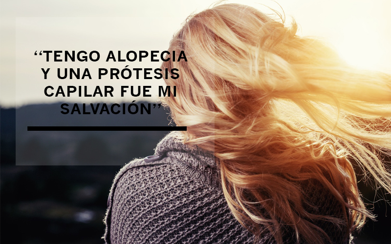 “Tengo alopecia y una prótesis capilar fue mi salvación”. Cada día pasan por nuestro centro muchas personas con problemas de alopecia y queremos ir contando sus experiencias por si os pueden ayudar. Hoy nos vamos a centrar en el caso de María una joven andaluza con alopecia androgenética. ¡Descubre cuál fue la solución para la alopecia!