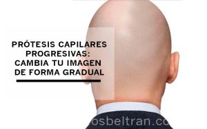Prótesis capilares progresivas: cambia tu imagen de forma gradual. Hay muchos hombres que cuando nos piden información de prótesis capilares nos plantean si es posible un cambio de imagen gradual. Y la respuesta que les damos siempre es que sí que es posible cambiar de imagen poco a poco. De hecho esta es la forma que más recomendamos para personas con una alopecia muy pronunciada.