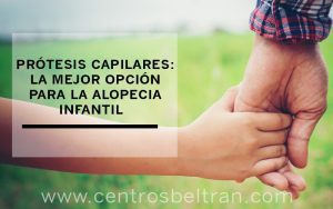 Prótesis capilares: la mejor opción para la alopecia infantil. Generalmente la alopecia aparece tanto en hombres y mujeres en la edad adulta pero también hay niños con problemas capilares desde pequeños. Estos pueden estar ocasionados tanto por alopecias cicatrizales como no cicatrizales y para ellos, en Centros Beltrán siempre recomendamos las prótesis capilares a medida por diferentes razonas. ¡Te las enumeramos!
