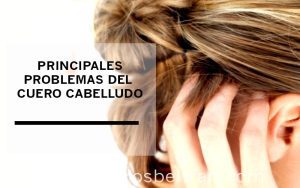 Principales problemas del cuero cabelludo