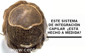 Cómo saber si un aumentador es estándar o está hecho a medida