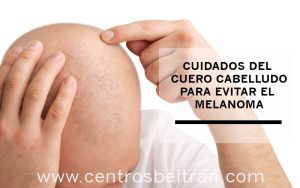 Cuidados del cuero cabelludo para evitar el melanoma