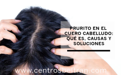 Prurito en el cuero cabelludo: qué es, causas y soluciones