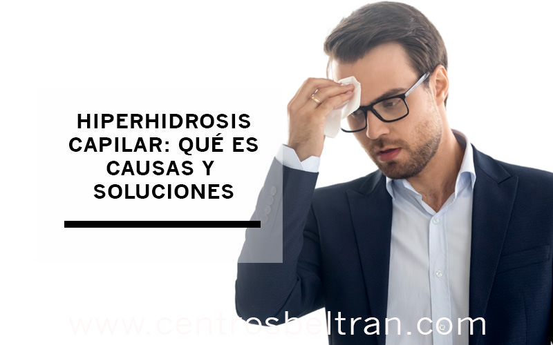 Hiperhidrosis capilar: qué es, causas y soluciones